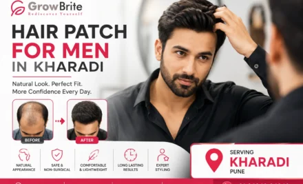 Hair Patch for Men in Kharadi – Natural Hair Replacement Solutions