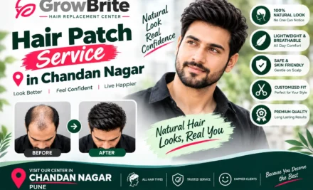 Hair Patch Price in Chandan Nagar – Complete Cost, Types & Buying Guide