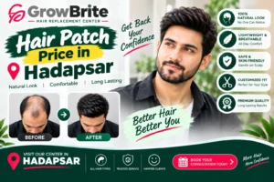 Hair Patch Price in Hadapsar – Complete Cost, Types & Buying Guide