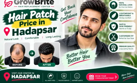 Hair Patch Price in Hadapsar – Complete Cost, Types & Buying Guide