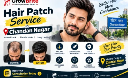 Hair Patch Service in Chandan Nagar: A Complete Guide to Natural-Looking Hair Replacement