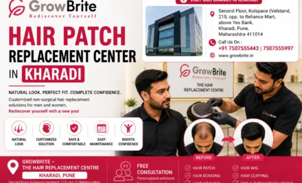 Hair Patch Replacement Center in Kharadi: Customized Hair Replacement Solutions
